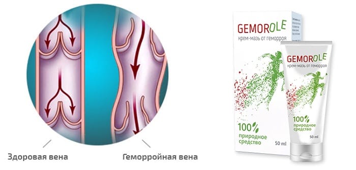 Геморект мазь от геморроя. Gemorole крем. Мазь от геморроя. Gemorole мазь производитель. Регемо крем от геморроя.