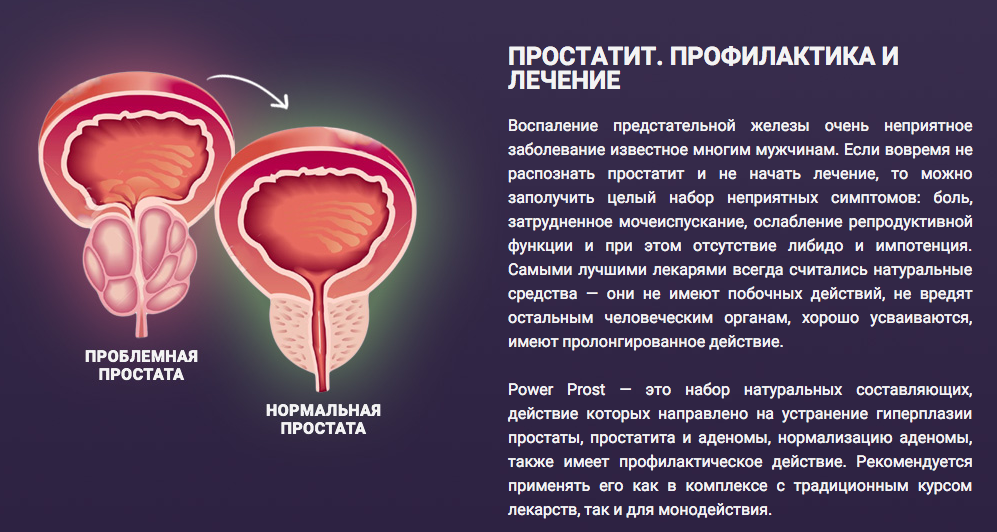 Воспаление в предстательной железе.