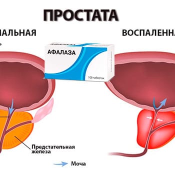 Афалаза отзывы мужчин. Афалаза. Афалаза таблетки. Лекарство от простатита Афалаза. Афалаза инструкция.