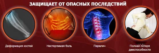 Arthron Meridian свойства