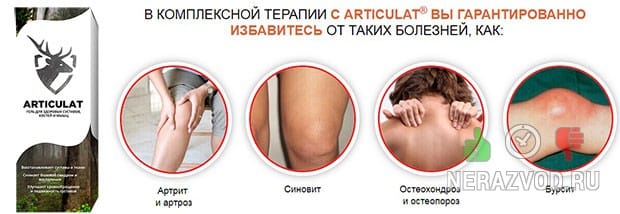 артрит