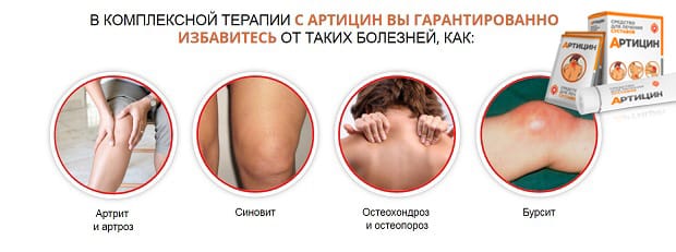 Больные суставы