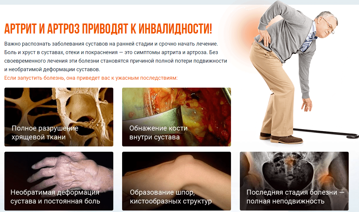 артрит и артроз приводят к инвалидности