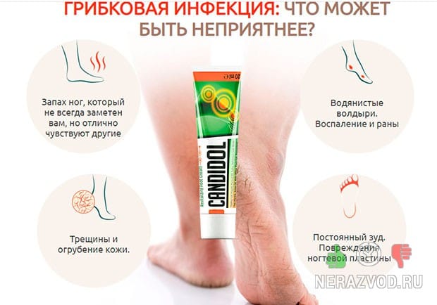 Candidol ΠΎΡ Π³ΡΠΈΠ±ΠΊΠΎΠ²ΡΡ
ΠΏΠΎΡΠ°ΠΆΠ΅Π½ΠΈΠΉ ΠΊΠΎΠΆΠ½ΡΡ
ΠΏΠΎΠΊΡΠΎΠ²ΠΎΠ²