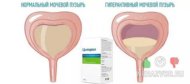 Π£ΡΠΈΠ»Π΅Π½Π½ΠΎΠ΅ ΠΌΠΎΡΠ΅ΠΈΡΠΏΡΡΠΊΠ°Π½ΠΈΠ΅