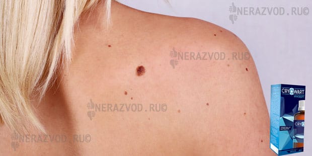 cryowart капли от папиллом цена