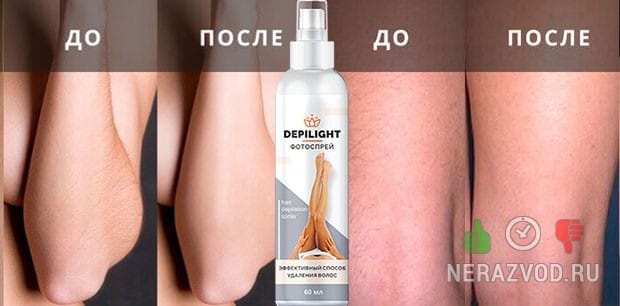 результаты депиляции