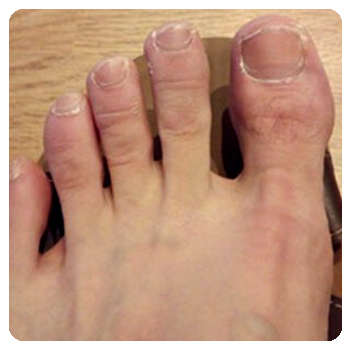 Благодаря мази RB Diet System ногти восстановились.