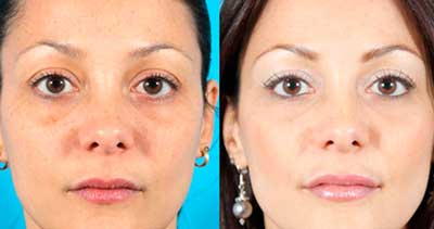 До и после использования Beauty Skin Care