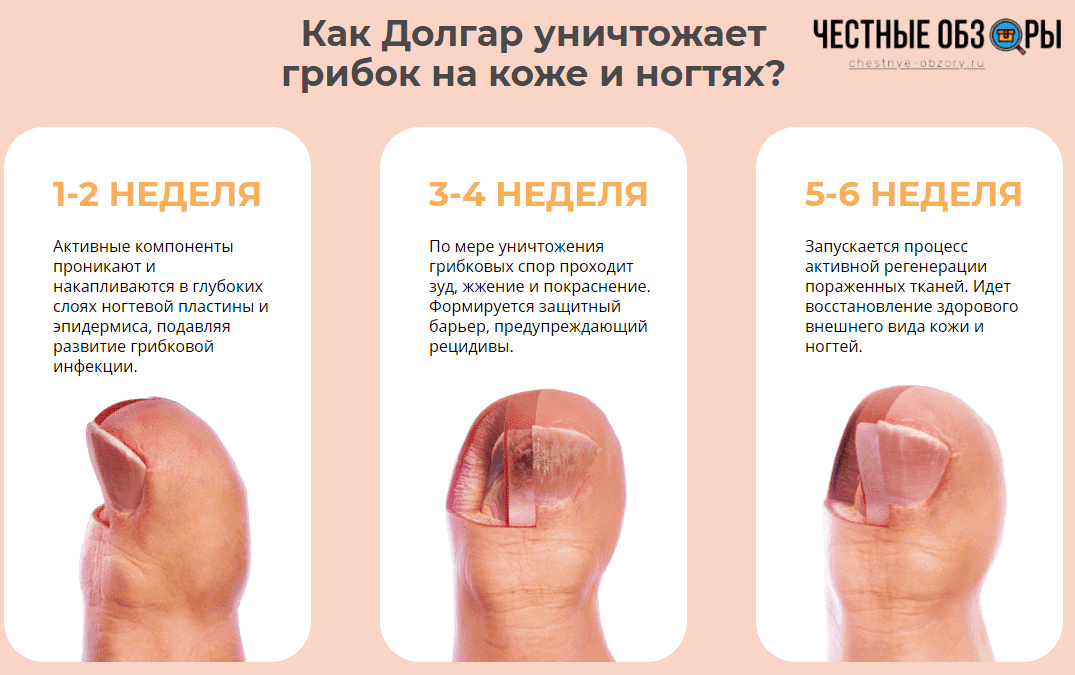 как долгар уничтожает грибок