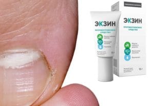 Где Купить Мазь Экзин От Грибка Ногтей