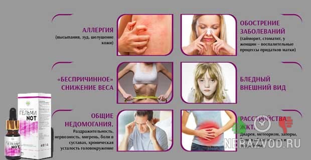 ГельмиNOT для очищения от паразитов