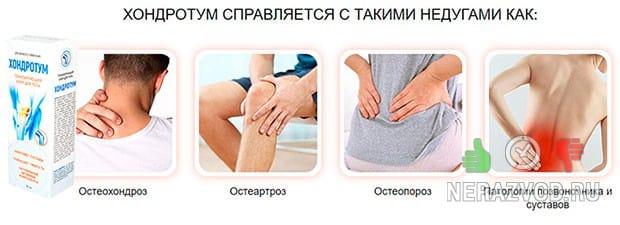 Проблемы с суставами
