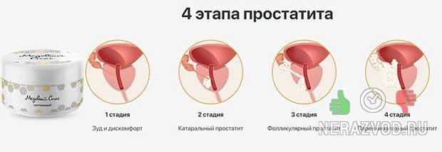 Крем Медовый спас интимный от простатита