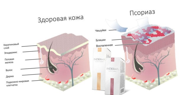 inderma от кожных воспалений цена