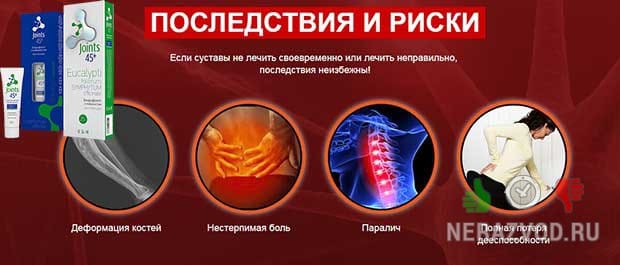 Патологии суставов