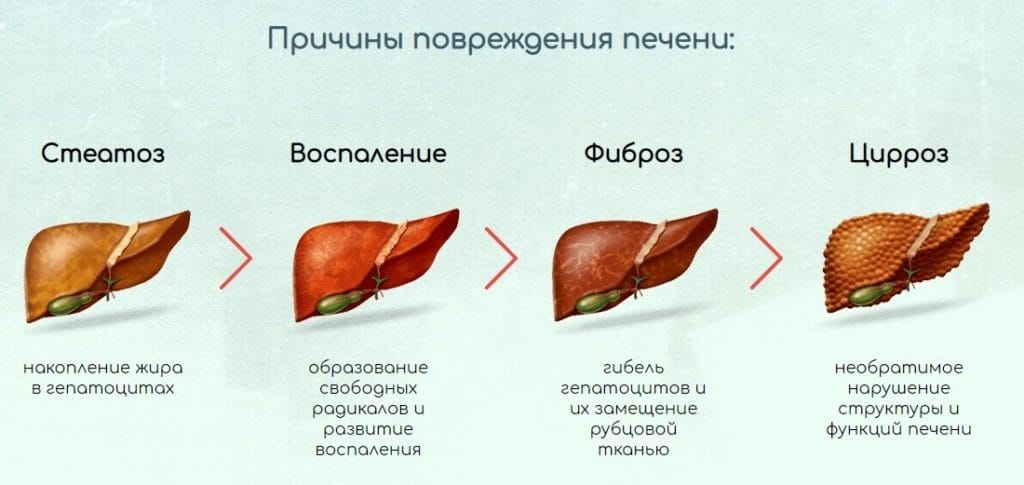 Грифола для печени стадии лечения