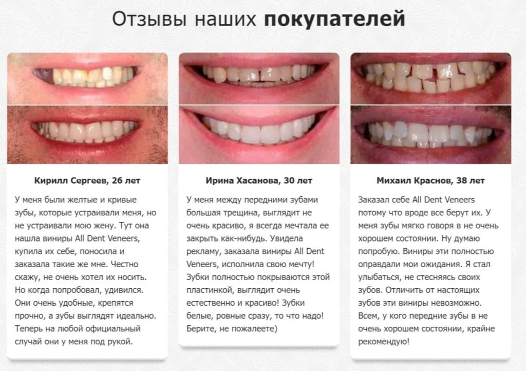 All Dent Veneers - отзывы реальных покупателей