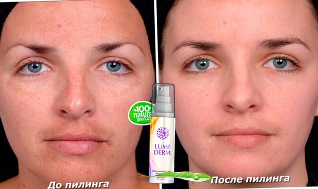 lumiderm ΠΏΠΈΠ»ΠΈΠ½Π³ ΡΠ΅Π½Π° ΡΠΎΡΡΠ°Π²