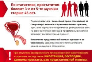 Простатиты У Мужчин Признаки Симптомы Фото