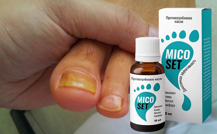 MICOSET от грибка ногтей: быстрое избавление от грибковой инфекции!