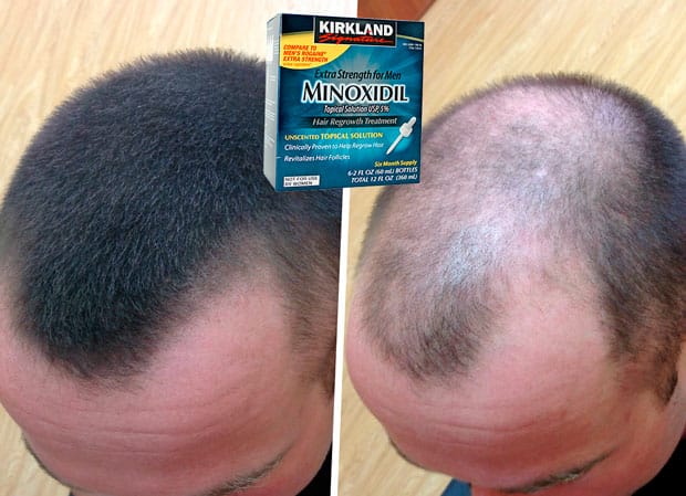kirkland minoxidil купить в Москве