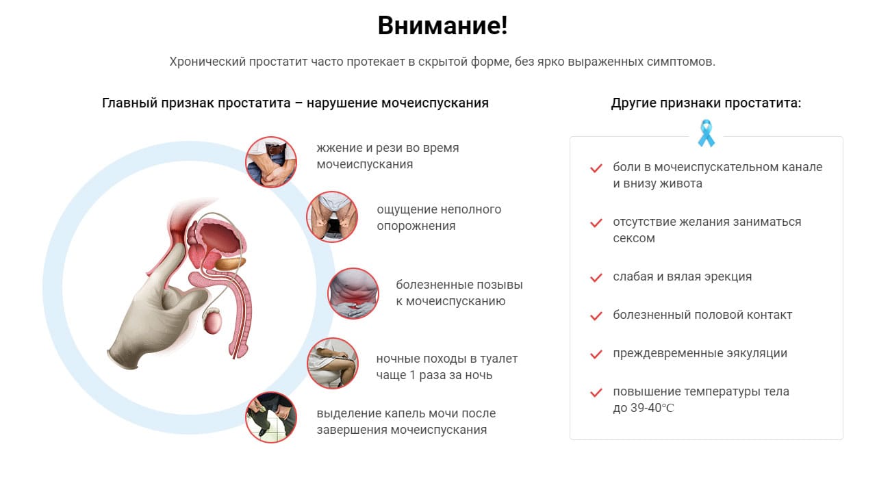 Мощный помощник при простатите Уромин купить по цене 1001 ₽ в Москве на  PromPortal.Su (ID#50773253)