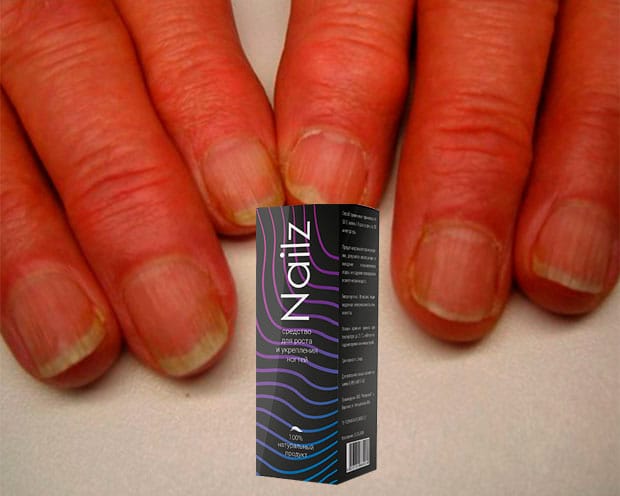 nailz состав, цена
