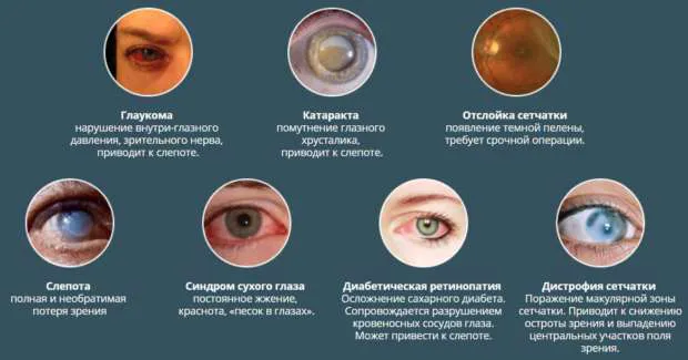 патологии глаза