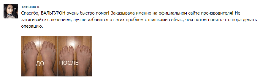 🧡Вальгурон крем-гель - реальные отзывы, цена, развод или правда ...