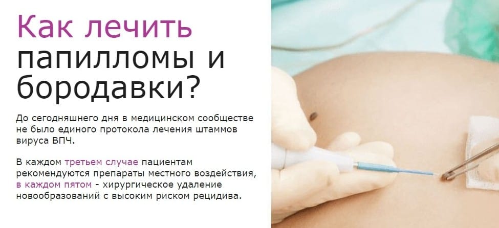 ΠΠ°ΠΏΠΈΠ»ΠΎΠ²ΠΈΡ ΠΎΡ ΠΏΠ°ΠΏΠΈΠ»Π»ΠΎΠΌ Π΄Π»Ρ ΡΠ΅Π³ΠΎ