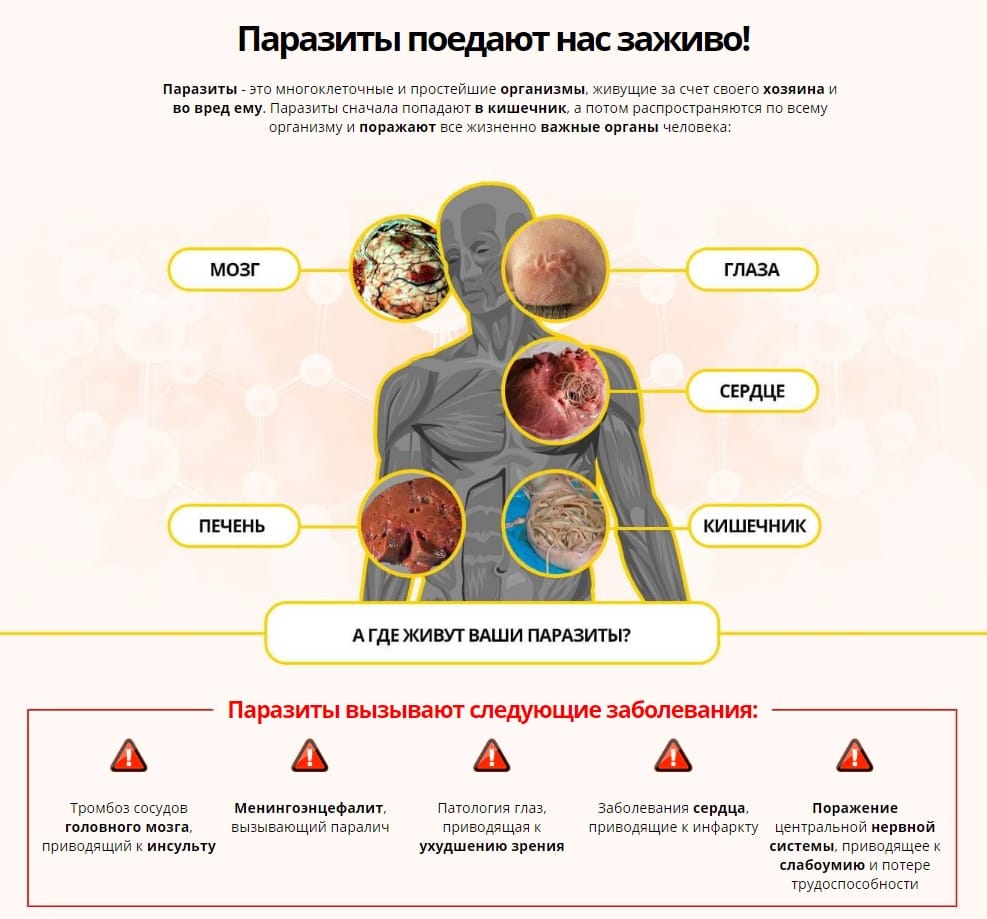 Паразиты в организме симптомы. Средство против паразитов в организме человека. Средство от паразитов в организме человека для профилактики. Лекарства от червей в организме человека.