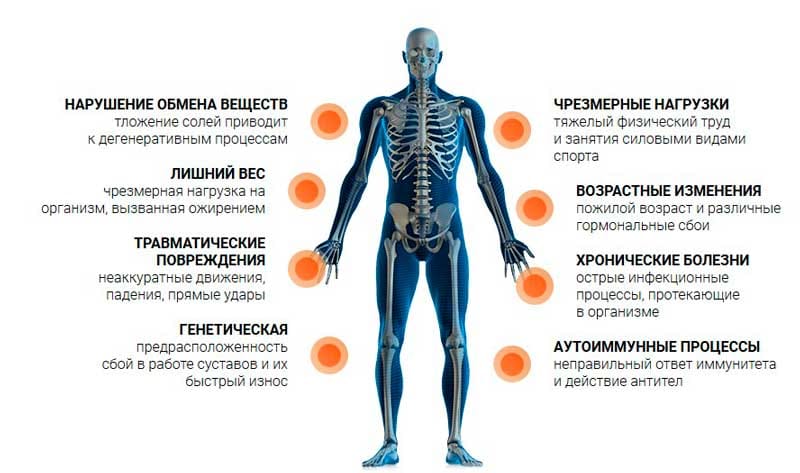 Причины заболевания суставов лечение