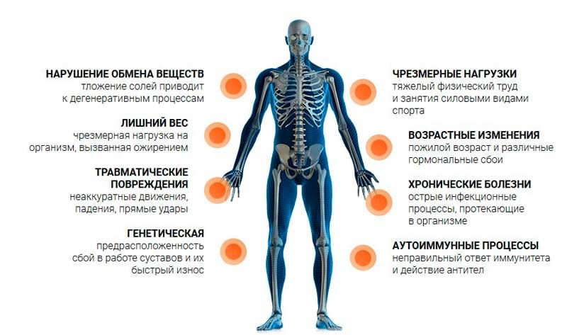 Болят все кости и мышцы причины. Перечень болезней суставов. Причины заболевания суставов. Болезни суставов список.