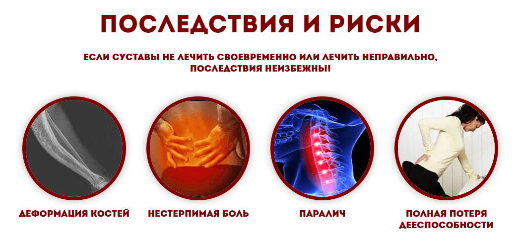 Развитие болезней суставов Последствия болезней суставов