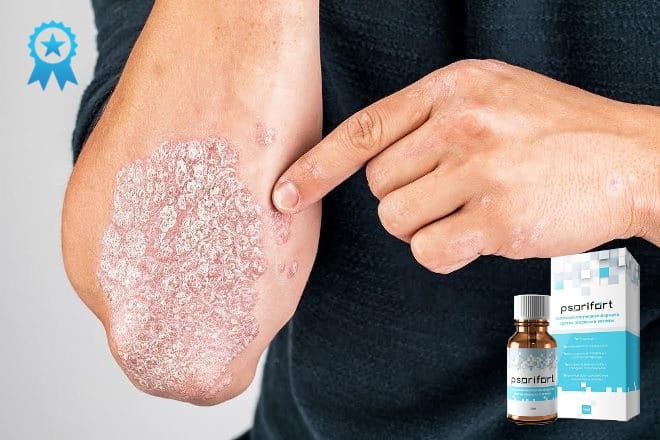Основные преимущества Psorifort