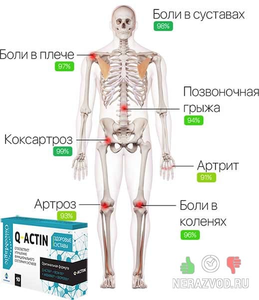 заболевания суставов и опорно-двигательного аппарата