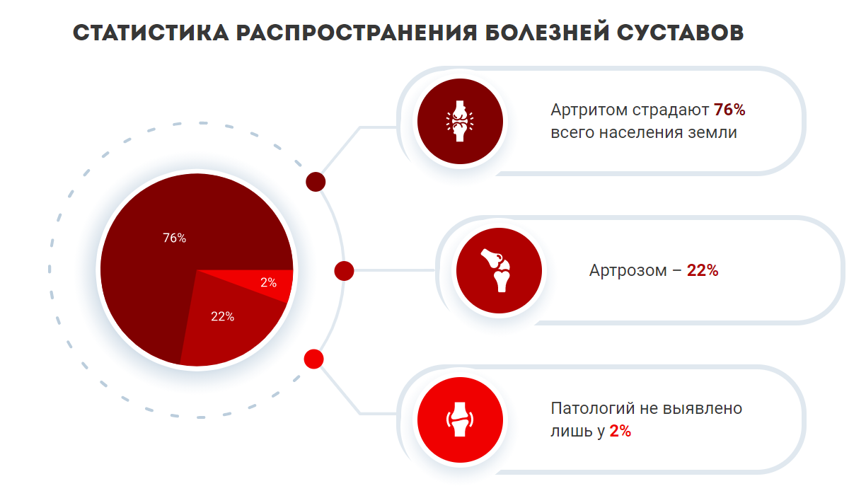 Гель СуставПро для суставов купить по цене 1149 ₽ в Москве на PromPortal.Su  (ID#51154638)