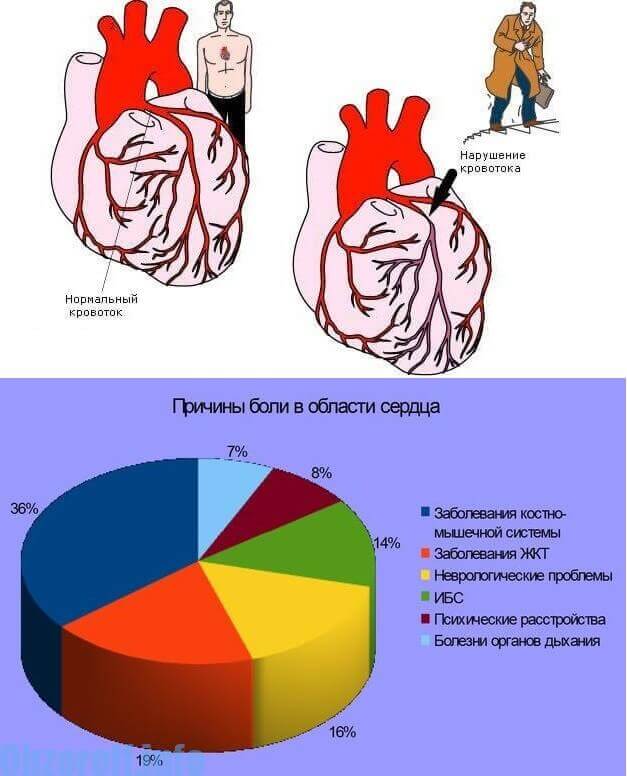 Причины боли в области сердца