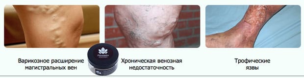 болезни ног