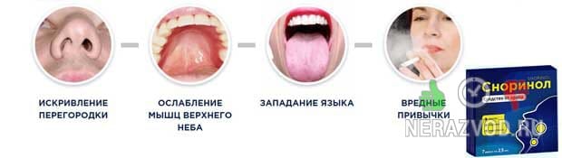 Сноринол - средство от храпа