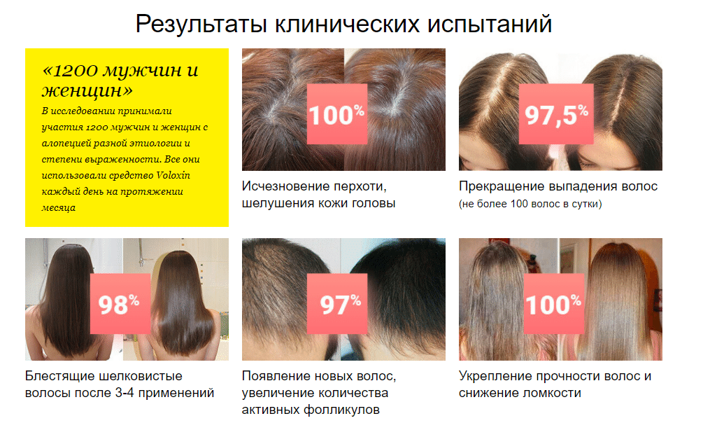 Сколько времени нужно волосам для восстановления после выпадения