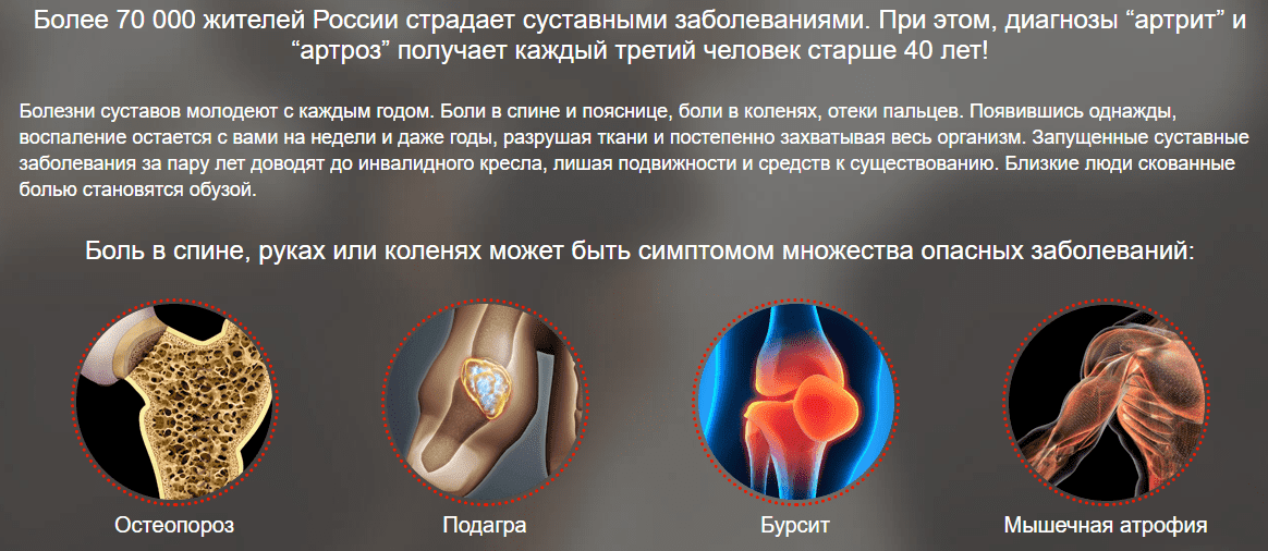 заболевание суставов