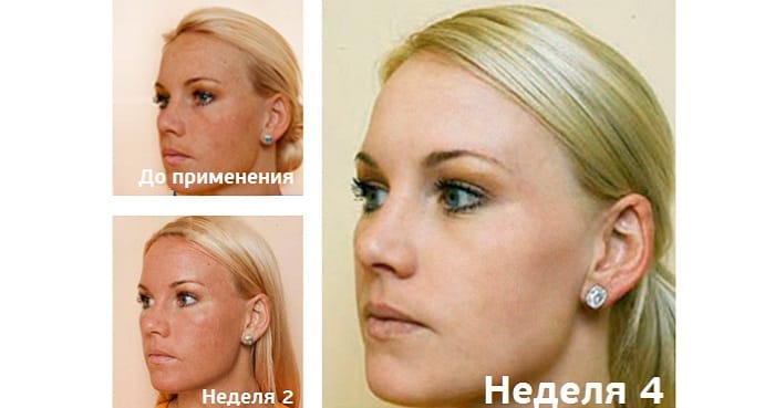 диабетеген результаты