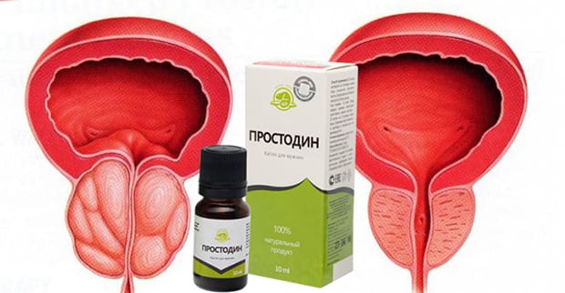 прост2