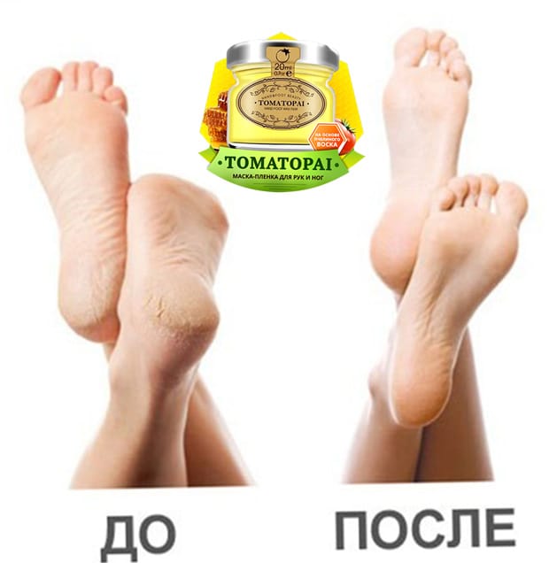 топ2