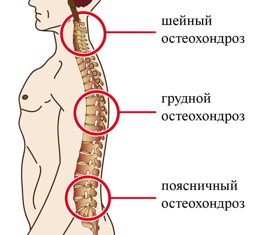 Характерные признаки заболевания